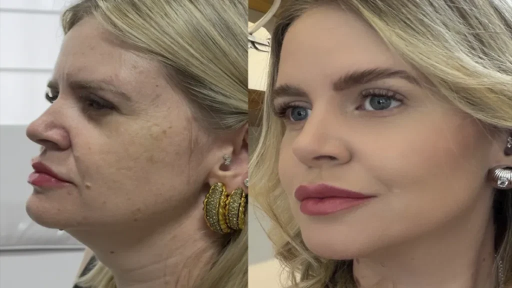Estética regenerativa: o novo luxo sem exageros