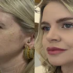 Estética regenerativa: o novo luxo sem exageros