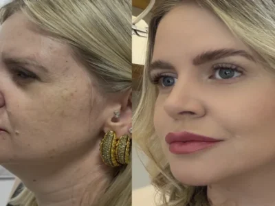 Estética regenerativa: o novo luxo sem exageros