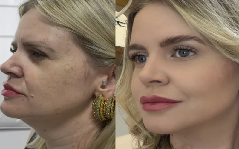 Estética regenerativa: o novo luxo sem exageros