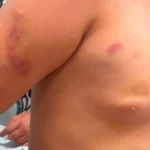 Padrasto preso após criança autista de 6 anos dar entrada ferida em hospital