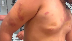 Padrasto preso após criança autista de 6 anos dar entrada ferida em hospital